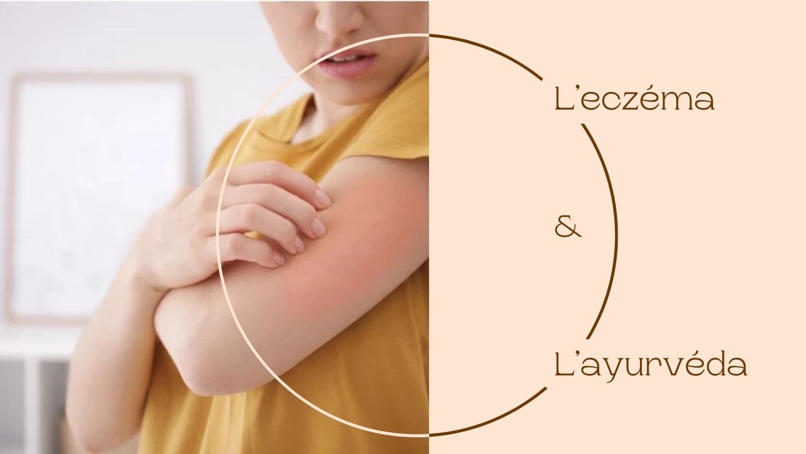 L’eczéma & l’ayurvéda
